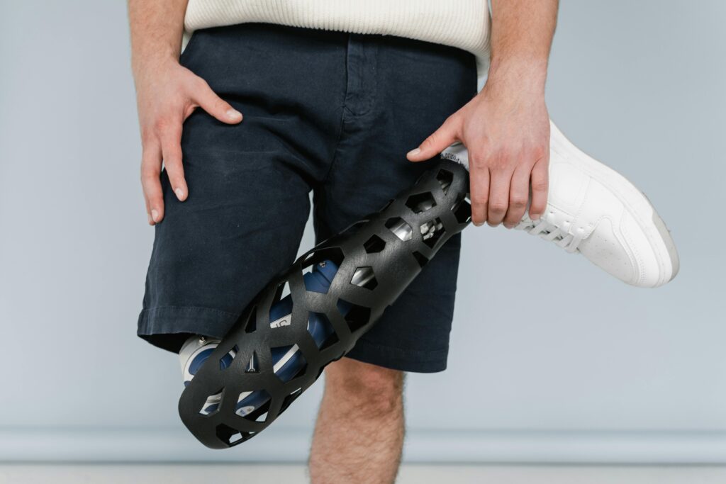 Close-up of a person with a sleek modern prosthetic leg, emphasizing cutting-edge design.